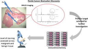 Cancer Risks, Signs, Symptoms, Tests, Treatments, and More